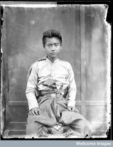 Siamese youth, photo by John Thomson. Courtesy of the Wellcome Library.